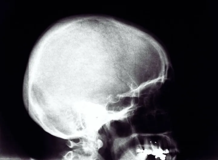 7 Errori Genitori Separati: Aiuta i Figli a Superare Tutto